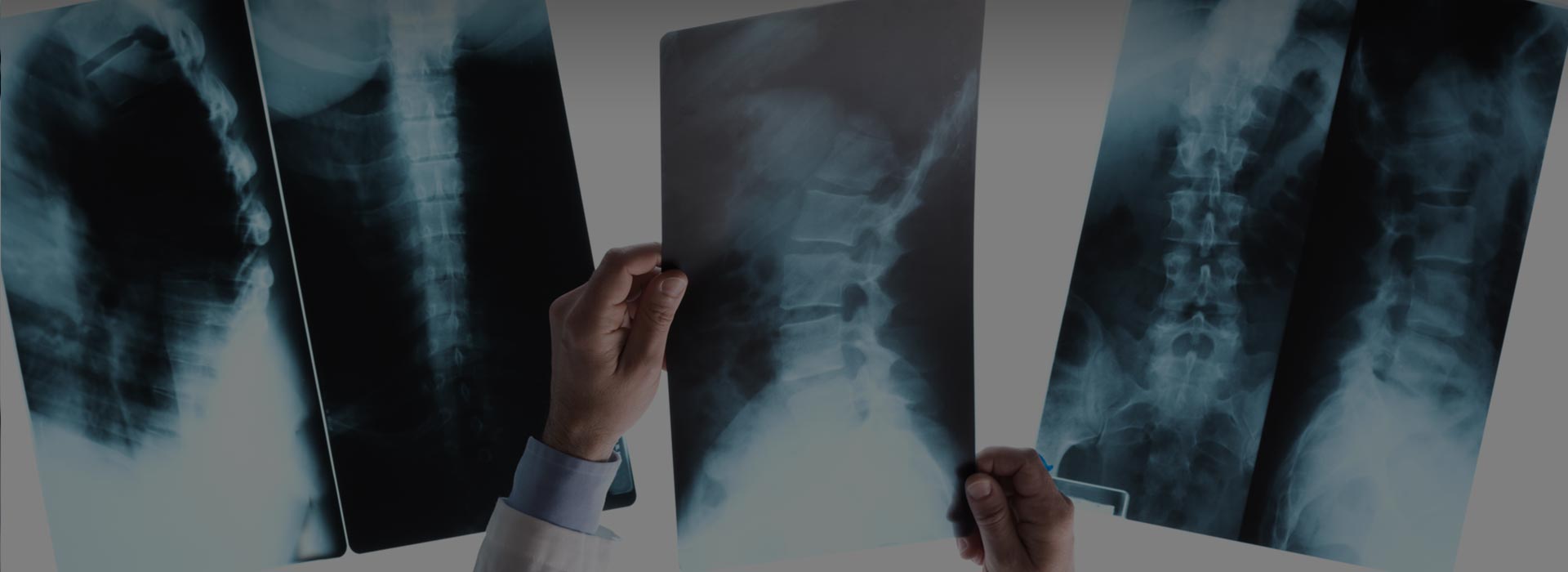 Look Well To The Spine For The Cause of Disease: Spinal Cord Injuries